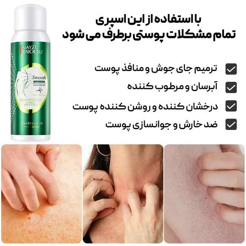 اسپری ضد جوش بدن سیازو | ضدجوش قوی با عصاره بابونه و سنتلا Siayzu Anti Acne Spra